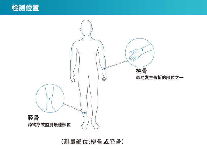 超声骨密度仪(桡骨/胫骨)