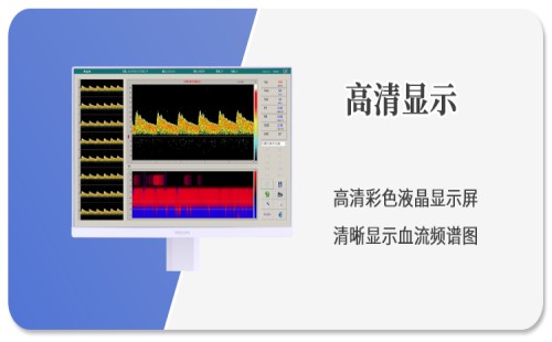 高清显示屏