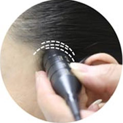 对于超声经颅多普勒，你了解多少？