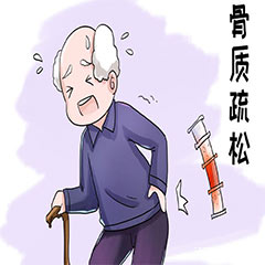 骨密度分析仪在检查骨密度中有什么作用？