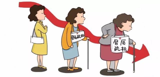 有这3个表现，一定要做骨密度检测