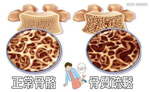 国产骨密度检查仪