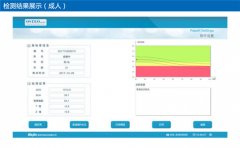 骨密度检查仪厂家介绍50岁以后骨密度多少是正常