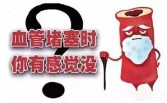 血管堵塞有哪些信号