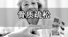 骨密度测量的时间和方法介绍