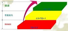 超声骨密度仪厂家介绍：两次骨密度检查结果如何对比