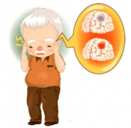 经颅多普勒是脑血管检查利器