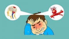 经颅多普勒厂家讲解：脑血管疾病有哪些发病征象