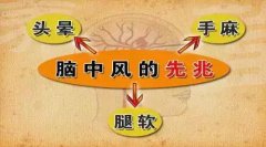 脑中风的前兆早知道 经颅多普勒帮助检查脑血管疾病