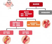 主要的脑血管疾病——脑卒中是如何分类的