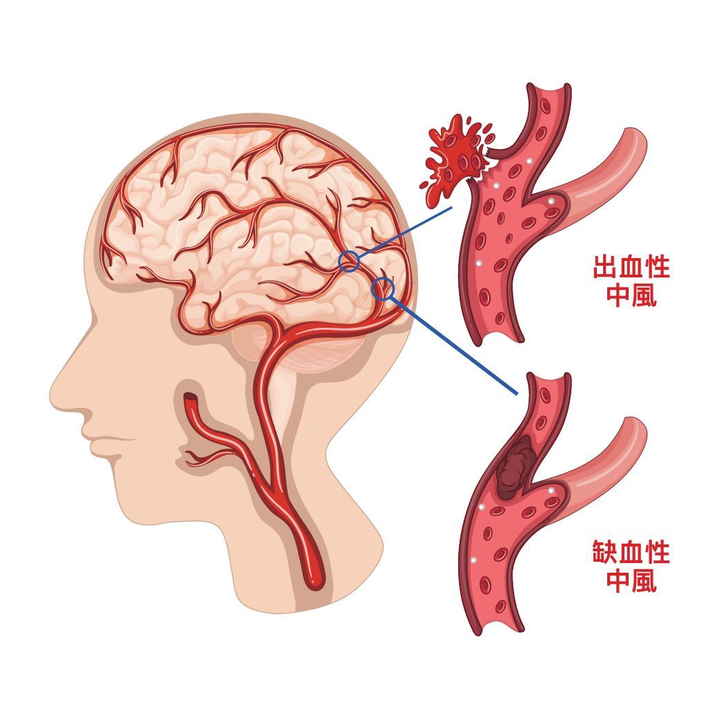 部委合并减少至18个_国家22部委联合发文_缺血预适应训练仪