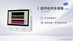 便携式经颅多普勒和台车型有哪些不同