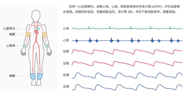 检测原理示意图